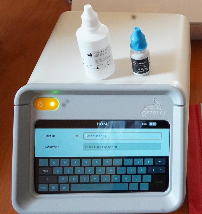 Siaya Strengthens Early Screening for Sickle Cell Disease with New Electrophoresis Machine
